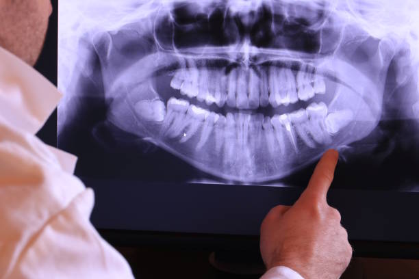 Best Broken or Cracked Tooth Emergency Dentist in King Arthur Park, MT